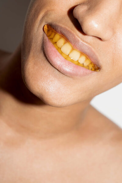 Lächelnder Mund mit Honig auf den Zähnen